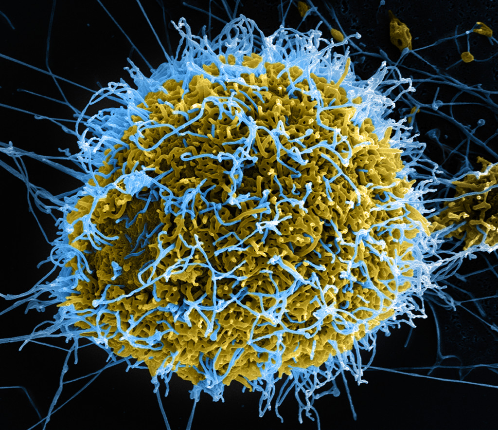 Ebola_Virus_Particles